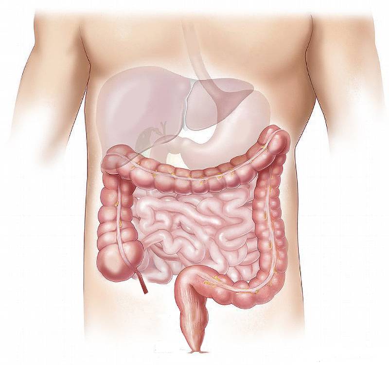 Crohn’s Disease FAQ Featured Image