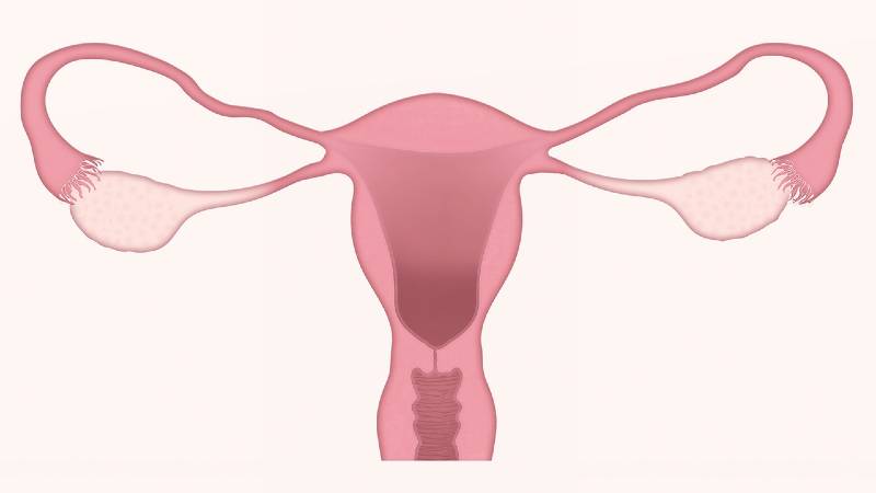 Endometriosis Risk Factors Featured Image