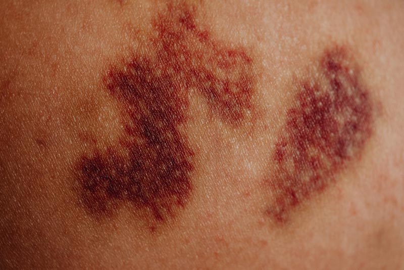 Skin conditions and sleep featured image
